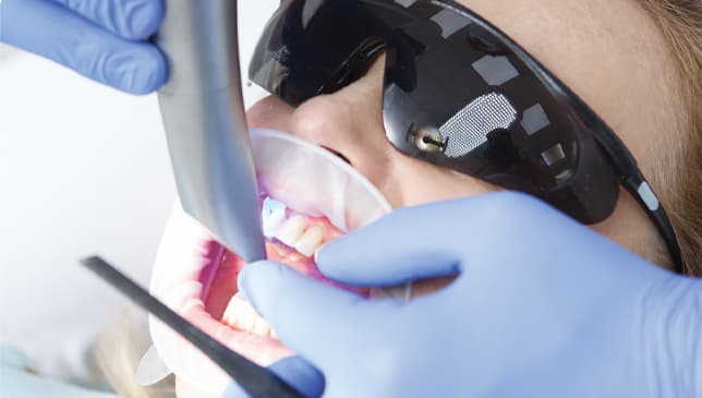 Intraoral Scanning Module